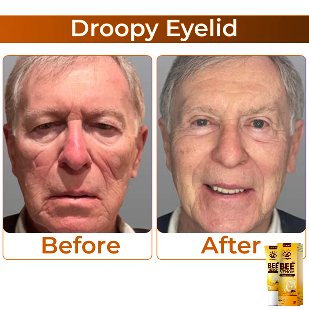 Mehiläisen myrkky+kolageeni: Herätä katseesi